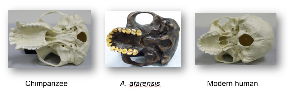 Foramen magnum